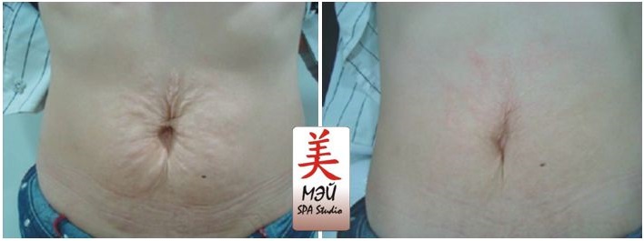 Mei spa studio rastiajki 5